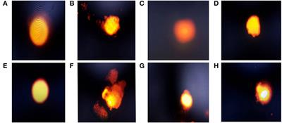 Modulatory effect of dietary probiotic and prebiotic supplementation on growth, immuno-biochemical alterations, DNA damage, and pathological changes in E. coli-infected broiler chicks